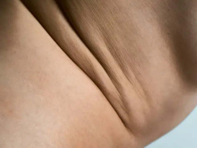A close-up of skin texture on the body